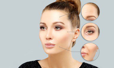 Aspects of aging on woman's face diagram